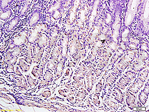 Formalin-fixed and paraffin embedded human gastric tissue labeled with Anti-Leptin Polyclonal Antibody (bs-0409R), Unconjugated at 1:300, followed by conjugation to the secondary antibody and DAB staining