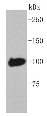 Recombinant MBP-tag protein lysates probed with Maltose Binding Protein (1F10) Monoclonal Antibody, Unconjugated (bsm-52296R) at 1:1000 overnight at 4°C followed by incubation with a conjugated secondary antibody at 1:20000 for 60 minutes at 37°C.