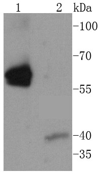 Lane 1: Jurkat Cells; Lane 2: Hela Cells; Probed with Caspase-8 (8D6) Monoclonal Antibody (bsm-52308R) at 1:1000, overnight at 4°C followed by a conjugated secondary antibody for 60 minutes at 37°C. Lane 1: Jurkat Cells; Lane 2: Hela Cells; Probed with Caspase-8 (8D6) Monoclonal Antibody (bsm-52308R) at 1:1000, overnight at 4°C followed by a conjugated secondary antibody for 60 minutes at 37°C.