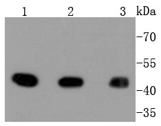 Lane 1: A431; Lane 2: HepG2; Lane 3: Hela lysate probed with MAP2K1 (7D8) Monoclonal Antibody (bsm-52311R) at 1:1000 overnight at 4°C followed by a conjugated secondary antibody for 60 minutes at 37°C.