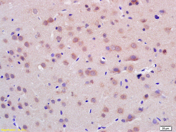 Formalin-fixed and paraffin embedded rat brain labeled with Anti-CHIP Polyclonal Antibody, Unconjugated (bs-15405R) at 1:200 followed by conjugation to the secondary antibody and DAB staining.