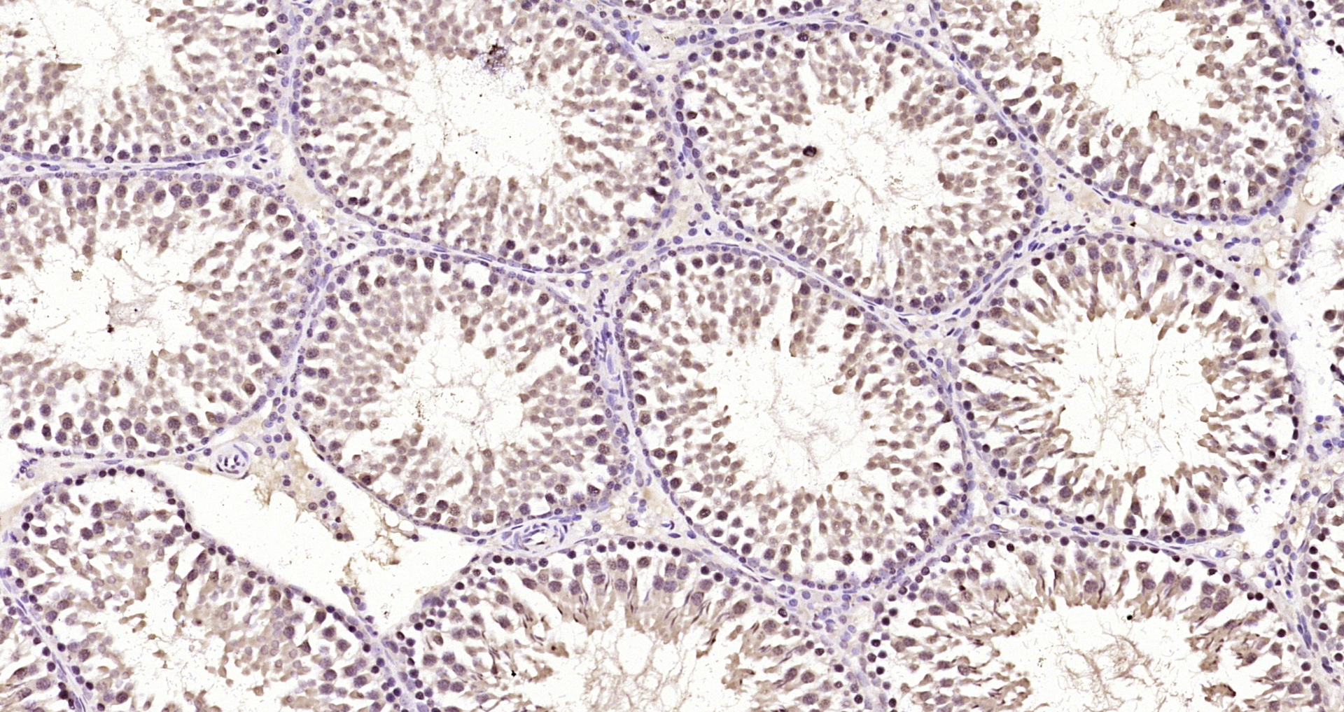 Paraformaldehyde-fixed, paraffin embedded Rat testis; Antigen retrieval by boiling in sodium citrate buffer (pH6.0) for 15min; Block endogenous peroxidase by 3% hydrogen peroxide for 20 minutes; Blocking buffer (normal goat serum) at 37°C for 30min; Antibody incubation with DYRK2 Polyclonal Antibody, Unconjugated (bs-12332R) at 1:200 overnight at 4°C, DAB staining.