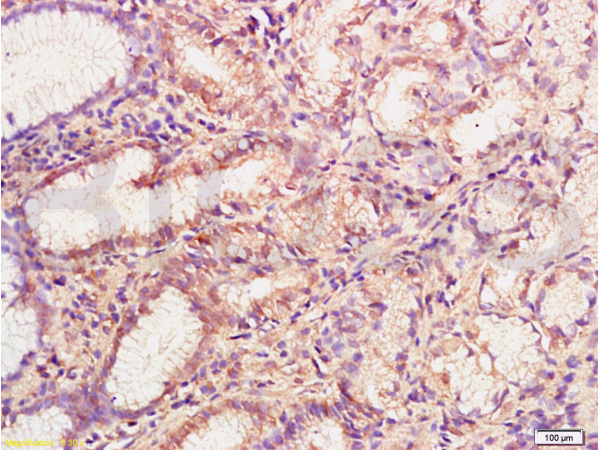 Formalin-fixed and paraffin embedded human gastric mucosa labeled with Anti-MMP-3 Polyclonal Antibody (bs-0413R), Unconjugated at 1:200, followed by conjugation to the secondary antibody and DAB staining