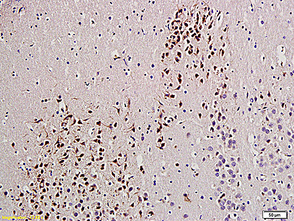 Formalin-fixed and paraffin embedded rat brain labeled with Anti-UCHL1\/PGP9.5 Polyclonal Antibody, Unconjugated (bs-3806R) at 1:200 followed by conjugation to the secondary antibody and DAB staining.