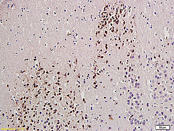 Formalin-fixed and paraffin embedded rat brain labeled with Anti-UCHL1/PGP9.5 Polyclonal Antibody, Unconjugated (bs-3806R) at 1:200 followed by conjugation to the secondary antibody and DAB staining.