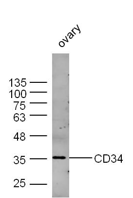 Lane 1: Mouse Ovary; Probed with CD34 Polyclonal Antibody, Unconjugated (bs-8996R) at 1:300 overnight at 4\u00b0C followed by a conjugated secondary antibody for 60 minutes at 37\u00b0C.