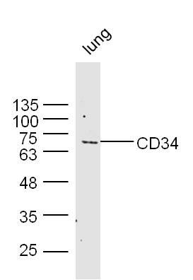 Lane 1: Mouse Lung; Probed with CD34 Polyclonal Antibody, Unconjugated (bs-8996R) at 1:300 overnight at 4°C followed by a conjugated secondary antibody for 60 minutes at 37°C.