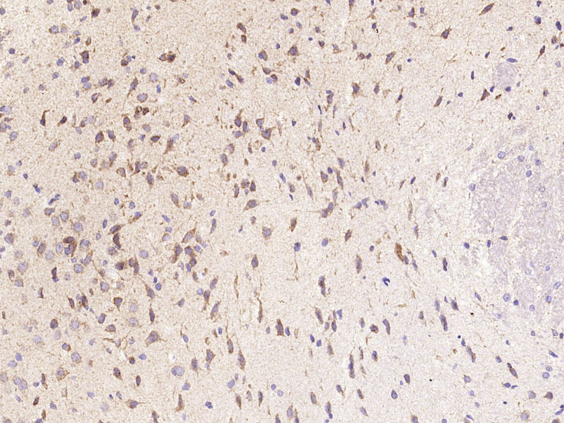 Paraformaldehyde-fixed, paraffin-embedded Rat Brain tissue; Antigen retrieval by boiling in sodium citrate buffer (0.01M, pH6) for 15 minutes; Block endogenous peroxidase by 3% hydrogen peroxide for 30 minutes; Blocking buffer (normal goat serum) at 37°C for 20 minutes; Antibody incubation with CXCL5 Polyclonal Antibody, Unconjugated (bs-2549R) at 1:400 overnight at 4°C, followed by a conjugated secondary antibody and DAB staining.