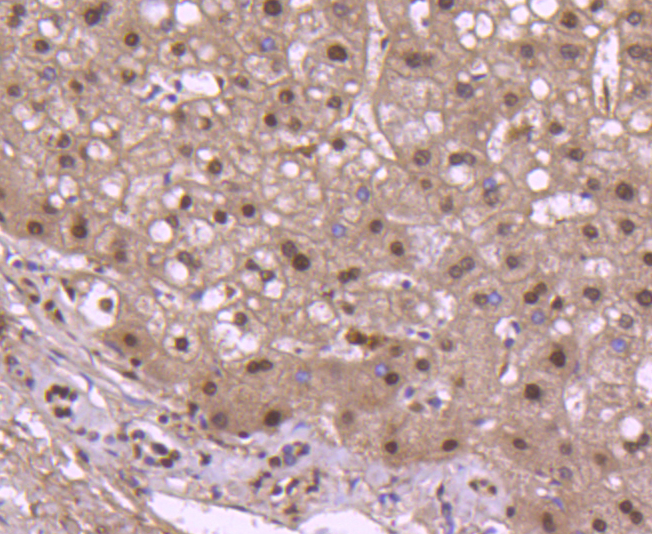 Paraformaldehyde-fixed and paraffin-embedded Human Liver tissue incubated with Histone H2B (3A6) Monoclonal Antibody (bsm-52099R) at 1:100, overnight at 4\u00b0C, followed by a conjugated secondary antibody and DAB staining. Counterstained with hematoxylin.