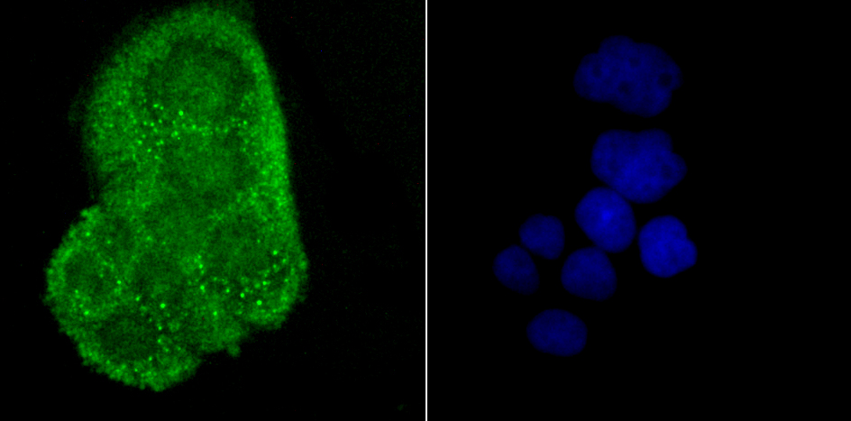 IF(ICC) staining with Alpha B Crystallin (1B12) Monoclonal Antibody (bsm-54032R) at 1:100 in Hela cells (green). The nuclear counterstain is DAPI (blue). Cells were fixed in paraformaldehyde, permeabilized with 0.25% Triton X100/PBS.