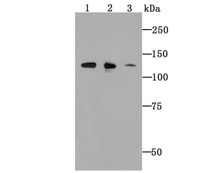 Lane 1: MCF-7Cells; Lane 2: Mouse Spleen; Lane 3: SH-SY5Y; Probed with ULK1 (2F3) Monoclonal Antibody (bsm-54034R) at 1:1000 overnight at 4°C followed by a conjugated secondary antibody for 60 minutes at 37°C. Lane 1: MCF-7Cells; Lane 2: Mouse Spleen; Lane 3: SH-SY5Y; Probed with ULK1 (2F3) Monoclonal Antibody (bsm-54034R) at 1:1000 overnight at 4°C followed by a conjugated secondary antibody for 60 minutes at 37°C.