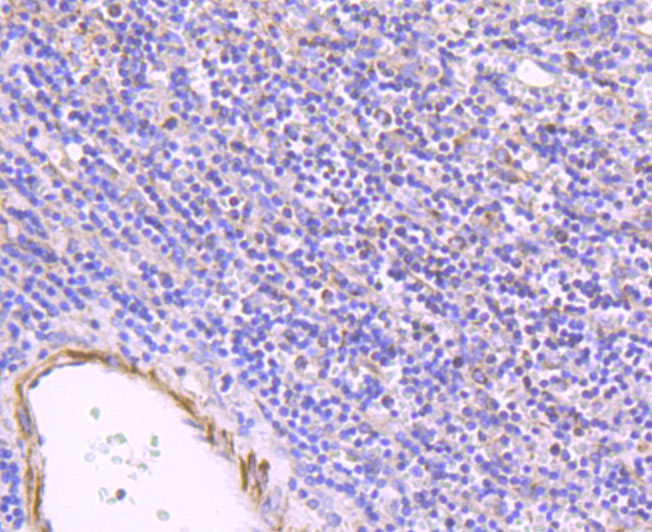 Paraformaldehyde-fixed and paraffin-embedded Human Spleen tissue incubated with ULK1 (2F3) Monoclonal Antibody (bsm-54034R) at 1:100, overnight at 4°C, followed by a conjugated secondary antibody and DAB staining. Counterstained with hematoxylin.