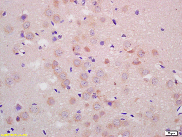 Formalin-fixed and paraffin embedded rat brain labeled with Anti-Parkin protein\/PARK2 Polyclonal Antibody, Unconjugated (bs-1865R) at 1:200 followed by conjugation to the secondary antibody and DAB staining.