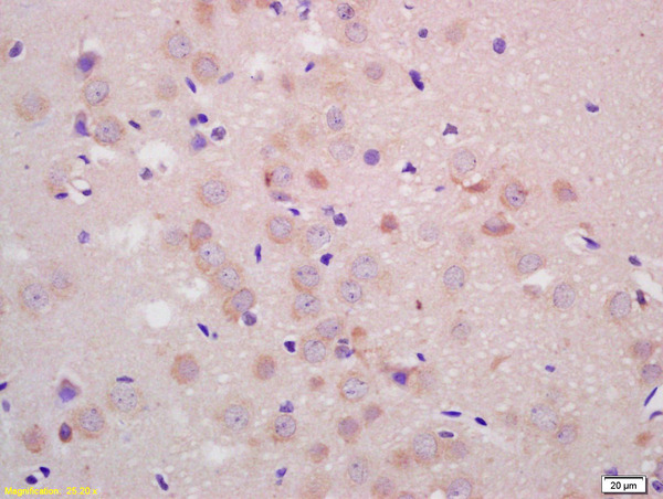 Formalin-fixed and paraffin embedded rat brain labeled with Anti-Parkin protein/PARK2 Polyclonal Antibody, Unconjugated (bs-1865R) at 1:200 followed by conjugation to the secondary antibody and DAB staining.
