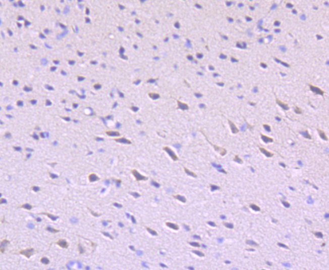 Paraformaldehyde-fixed and paraffin-embedded Mouse Brain tissue incubated with ULK1 (2F3) Monoclonal Antibody (bsm-54034R) at 1:100, overnight at 4°C, followed by a conjugated secondary antibody and DAB staining. Counterstained with hematoxylin.