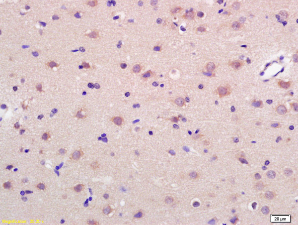 Formalin-fixed and paraffin embedded rat brain labeled with Anti-GRP75 Polyclonal Antibody, Unconjugated (bs-1469R) at 1:200 followed by conjugation to the secondary antibody and DAB staining.