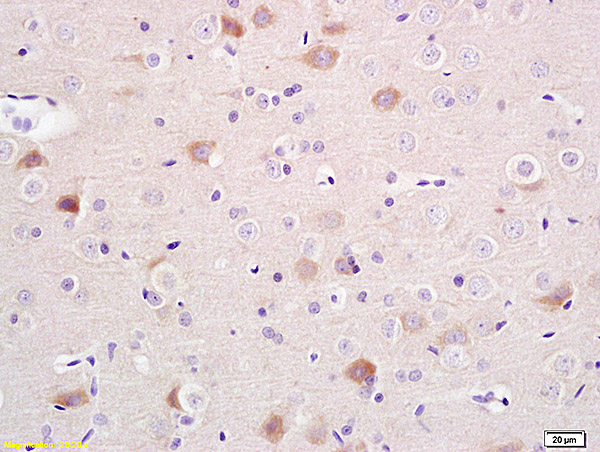 Formalin-fixed and paraffin embedded rat brain labeled with Mouse Anti-\u03b1-Synuclein Polyclonal Antibody, Unconjugated (bs-0012M) at 1:200 followed by conjugation to the secondary antibody and DAB staining