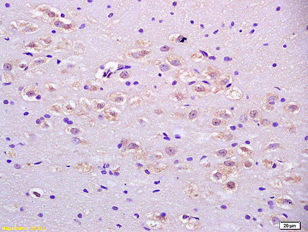 Formalin-fixed and paraffin embedded rat brain labeled with Anti-IDH3A Polyclonal Antibody, Unconjugated (bs-3946R) at 1:200 followed by conjugation to the secondary antibody and DAB staining.
