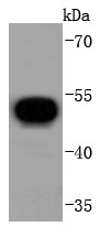 V5-tagged recombinant protein lysates probed with V5 tag (4C3) Monoclonal Antibody (bsm-52350R) at 1:1000 dilution and 4˚C overnight incubation. Followed by conjugated secondary antibody incubation for 60 min at 37˚C.