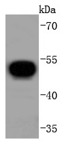 V5-tagged recombinant protein lysates probed with V5 tag (4C3) Monoclonal Antibody (bsm-52350R) at 1:1000 dilution and 4˚C overnight incubation. Followed by conjugated secondary antibody incubation for 60 min at 37˚C. V5-tagged recombinant protein lysates probed with V5 tag (4C3) Monoclonal Antibody (bsm-52350R) at 1:1000 dilution and 4˚C overnight incubation. Followed by conjugated secondary antibody incubation for 60 min at 37˚C.