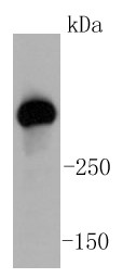 CRC cell lysates probed with ATM (12A) Monoclonal Antibody (bsm-52360R) at 1:1000 dilution and 4˚C overnight incubation. Followed by conjugated secondary antibody incubation at 1:20000 for 60 min at 37˚C. CRC cell lysates probed with ATM (12A) Monoclonal Antibody (bsm-52360R) at 1:1000 dilution and 4˚C overnight incubation. Followed by conjugated secondary antibody incubation at 1:20000 for 60 min at 37˚C.