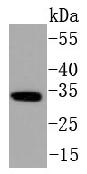 Hela cell lysates probed with NGF (11G1) Monoclonal Antibody (bsm-52362R) at 1:1000 dilution and 4˚C overnight incubation. Followed by conjugated secondary antibody incubation for 60 min at 37˚C.