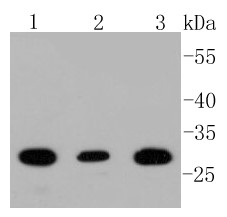Lane 1: SHG-44 cell lysates; Lane 2: A172 cell lysates; Lane 3: Mouse brain lysates probed with BDNF (2A1) Monoclonal Antibody (bsm-52368R) at 1:1000 dilution and 4˚C overnight incubation. Followed by conjugated secondary antibody incubation for 60 min at 37˚C.