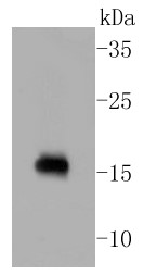 Rat brain lysates probed with Calmodulin (1E8 ) Monoclonal Antibody (bsm-52371R) at 1:1000 dilution and 4˚C overnight incubation. Followed by conjugated secondary antibody incubation for 60 min at 37˚C. Rat brain lysates probed with Calmodulin (1E8 ) Monoclonal Antibody (bsm-52371R) at 1:1000 dilution and 4˚C overnight incubation. Followed by conjugated secondary antibody incubation for 60 min at 37˚C.