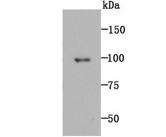 Lane 1: Rat Spleen; Probed with MMP9 (7D6) Monoclonal Antibody (bsm-54040R) at 1:1000 overnight at 4\u00b0C followed by a conjugated secondary antibody for 60 minutes at 37\u00b0C.