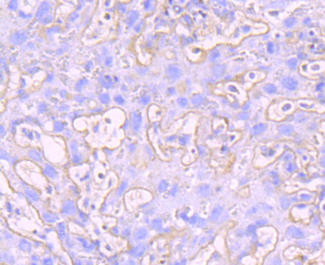 Paraformaldehyde-fixed and paraffin-embedded Mouse Placenta tissue incubated with MMP9 (7D6) Monoclonal Antibody (bsm-54040R) at 1:100, overnight at 4\u00b0C, followed by a conjugated secondary antibody and DAB staining. Counterstained with hematoxylin.