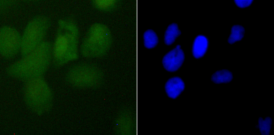 IF(ICC) staining with PDCD4 (3G1) Monoclonal Antibody (bsm-54041R) at 1:50 in A431 cells (green). The nuclear counterstain is DAPI (blue). Cells were fixed in paraformaldehyde, permeabilized with 0.25% Triton X100/PBS.