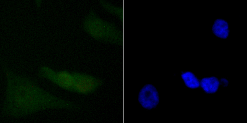 IF(ICC) staining with PDCD4 (3G1) Monoclonal Antibody (bsm-54041R) at 1:50 in PC-3M cells (green). The nuclear counterstain is DAPI (blue). Cells were fixed in paraformaldehyde, permeabilized with 0.25% Triton X100/PBS.