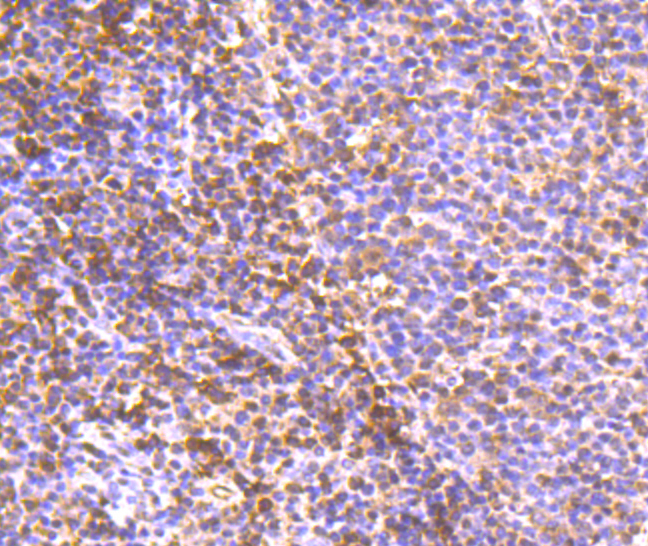 Paraformaldehyde-fixed and paraffin-embedded Human Tonsil tissue incubated with PDCD4 (3G1) Monoclonal Antibody (bsm-54041R) at 1:100, overnight at 4°C, followed by a conjugated secondary antibody and DAB staining. Counterstained with hematoxylin.