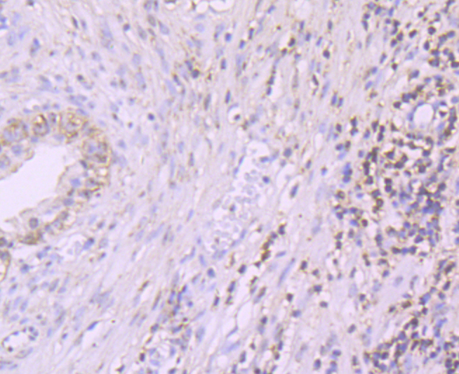Paraformaldehyde-fixed and paraffin-embedded Human Prostate tissue incubated with PDCD4 (3G1) Monoclonal Antibody (bsm-54041R) at 1:100, overnight at 4°C, followed by a conjugated secondary antibody and DAB staining. Counterstained with hematoxylin.