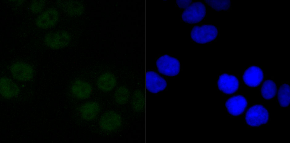 IF(ICC) staining with Sin3A (3A6) Monoclonal Antibody (bsm-54058R) at 1:100 in Hela cells (green). The nuclear counterstain is DAPI (blue). Cells were fixed in paraformaldehyde, permeabilized with 0.25% Triton X100/PBS.