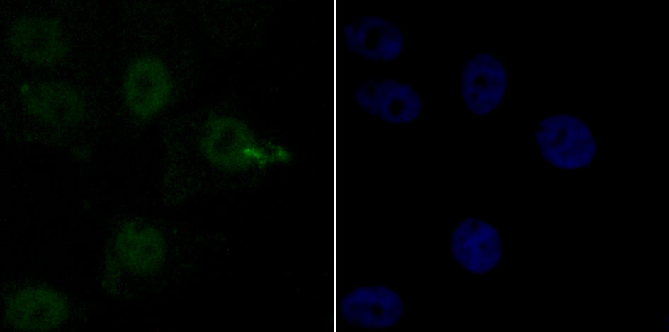 IF(ICC) staining with Sin3A (3A6) Monoclonal Antibody (bsm-54058R) at 1:100 in MCF-7 cells (green). The nuclear counterstain is DAPI (blue). Cells were fixed in paraformaldehyde, permeabilized with 0.25% Triton X100/PBS.