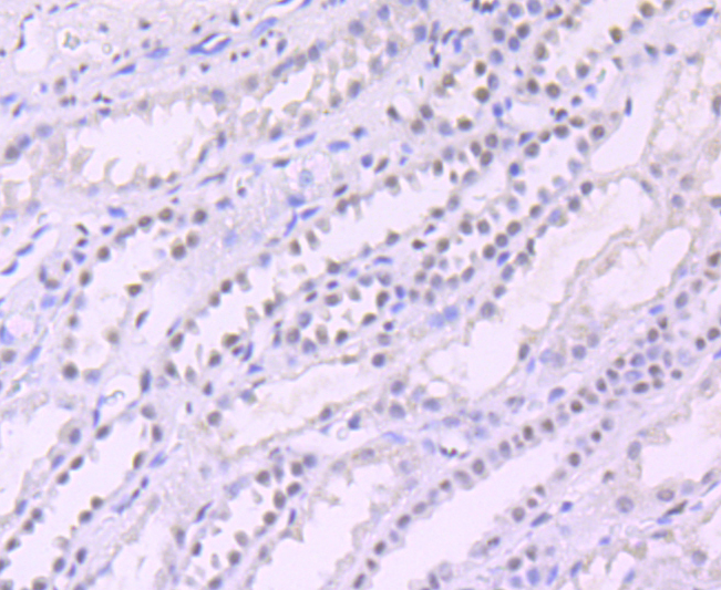 Paraformaldehyde-fixed and paraffin-embedded Human Kidney tissue incubated with Sin3A (3A6) Monoclonal Antibody (bsm-54058R) at 1:100, overnight at 4°C, followed by a conjugated secondary antibody and DAB staining. Counterstained with hematoxylin.