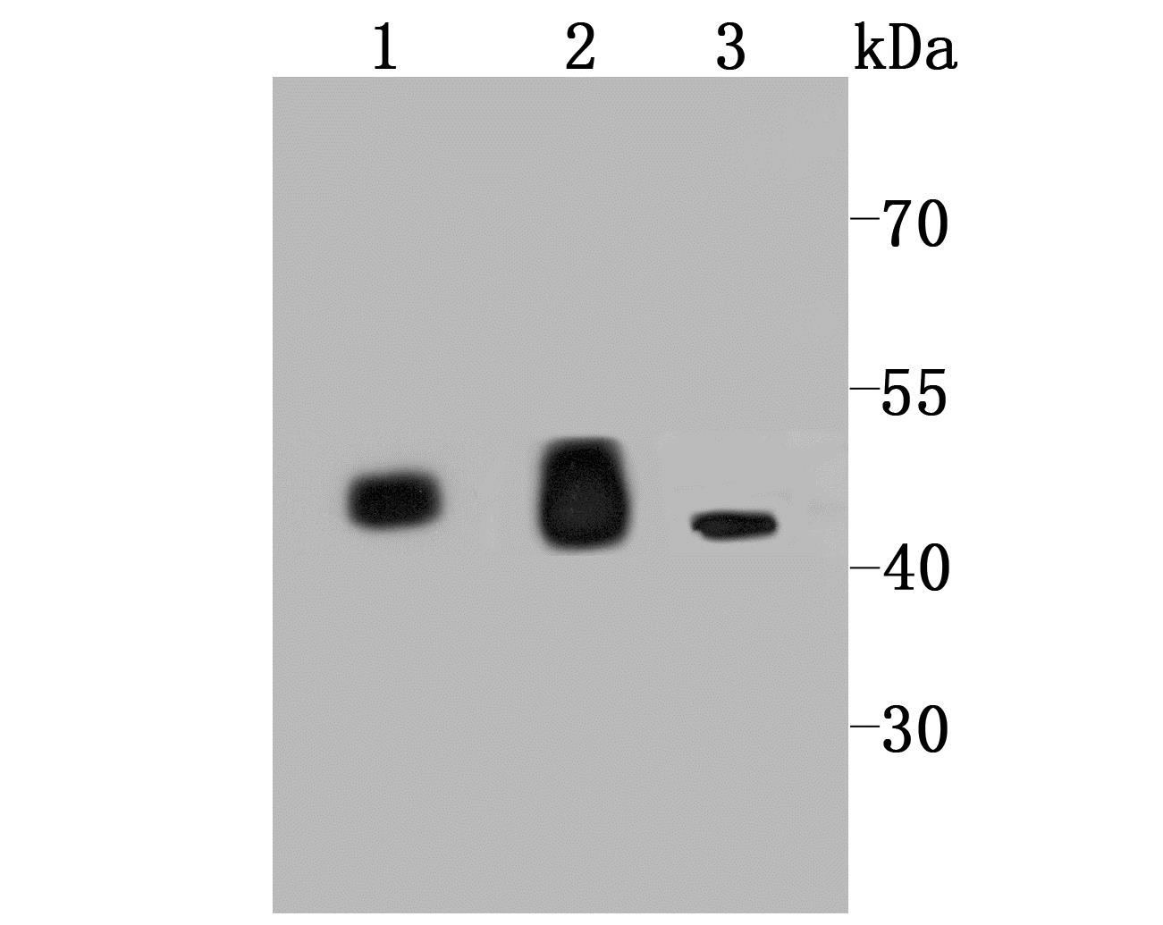 Lane 1: Mouse Heart; Lane 2: Rat Heart; Lane 3: 293T Cells; Probed with IDH2 (2G2) Monoclonal Antibody (bsm-54060R) at 1:1000 overnight at 4°C followed by a conjugated secondary antibody for 60 minutes at 37°C. Lane 1: Mouse Heart; Lane 2: Rat Heart; Lane 3: 293T Cells; Probed with IDH2 (2G2) Monoclonal Antibody (bsm-54060R) at 1:1000 overnight at 4°C followed by a conjugated secondary antibody for 60 minutes at 37°C.