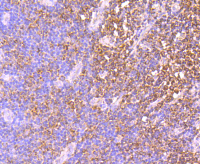 Paraformaldehyde-fixed and paraffin-embedded Human Tonsil tissue incubated IDH2 (2G2) Monoclonal Antibody (bsm-54060R) at 1:100, overnight at 4°C, followed by a conjugated secondary antibody and DAB staining. Counterstained with hematoxylin.