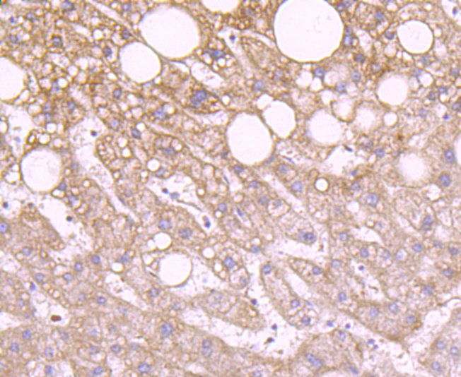 Paraformaldehyde-fixed and paraffin-embedded Human Liver tissue incubated IDH2 (2G2) Monoclonal Antibody (bsm-54060R) at 1:100, overnight at 4°C, followed by a conjugated secondary antibody and DAB staining. Counterstained with hematoxylin.