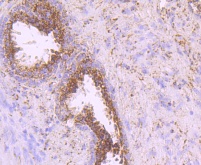 Paraformaldehyde-fixed and paraffin-embedded Human Prostate tissue incubated IDH2 (2G2) Monoclonal Antibody (bsm-54060R) at 1:100, overnight at 4°C, followed by a conjugated secondary antibody and DAB staining. Counterstained with hematoxylin.