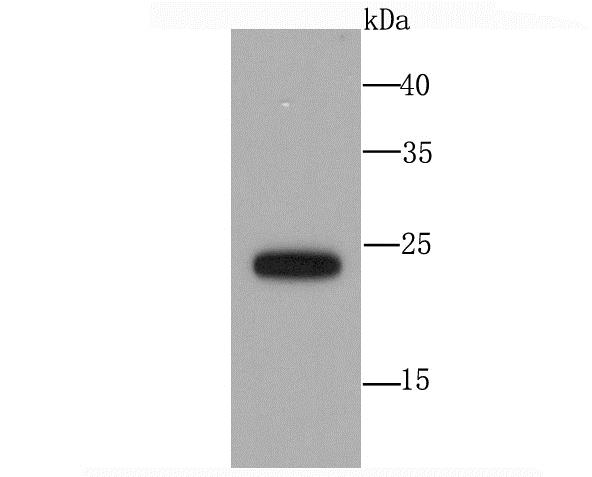 Lane 1: Hela Cells; Probed with SNAP23 (1G3) Monoclonal Antibody (bsm-54062R) at 1:1000 overnight at 4°C followed by a conjugated secondary antibody for 60 minutes at 37°C.