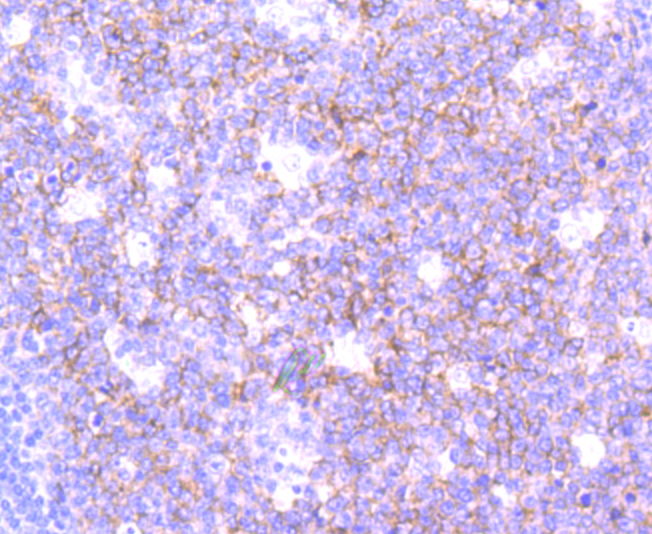 Paraformaldehyde-fixed and paraffin-embedded Human Tonsil tissue incubated SNAP23 (1G3) Monoclonal Antibody (bsm-54062R) at 1:100, overnight at 4°C, followed by a conjugated secondary antibody and DAB staining. Counterstained with hematoxylin.