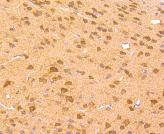 Paraformaldehyde-fixed and paraffin-embedded Mouse Brain tissue incubated Zic1 (3G7) Monoclonal Antibody (bsm-54063R) at 1:100, overnight at 4°C, followed by a conjugated secondary antibody and DAB staining. Counterstained with hematoxylin.