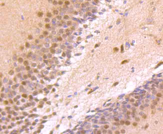 Paraformaldehyde-fixed and paraffin-embedded Rat Brain tissue incubated Zic1 (3G7) Monoclonal Antibody (bsm-54063R) at 1:100, overnight at 4°C, followed by a conjugated secondary antibody and DAB staining. Counterstained with hematoxylin.