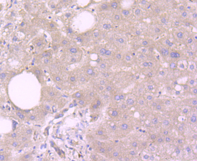 Paraformaldehyde-fixed and paraffin-embedded Human Liver tissue incubated with Reelin (4C3) Monoclonal Antibody (bsm-54065R) at 1:100, overnight at 4°C, followed by a conjugated secondary antibody and DAB staining. Counterstained with hematoxylin.