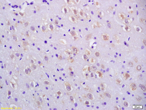 Formalin-fixed and paraffin embedded rat brain labeled with Anti-CCDC11 Polyclonal Antibody, Unconjugated (bs-7740R) at 1:200 followed by conjugation to the secondary antibody and DAB staining.