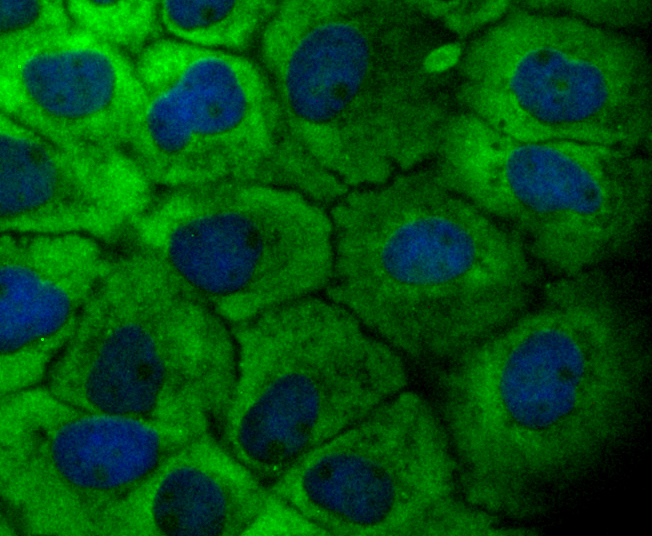 IF(ICC) staining with MAP3K7 (11A1) Monoclonal Antibody (bsm-54071R) at 1:100 in A431 cells (green). The nuclear counterstain is DAPI (blue). Cells were fixed in paraformaldehyde, permeabilized with 0.25% Triton X100/PBS.