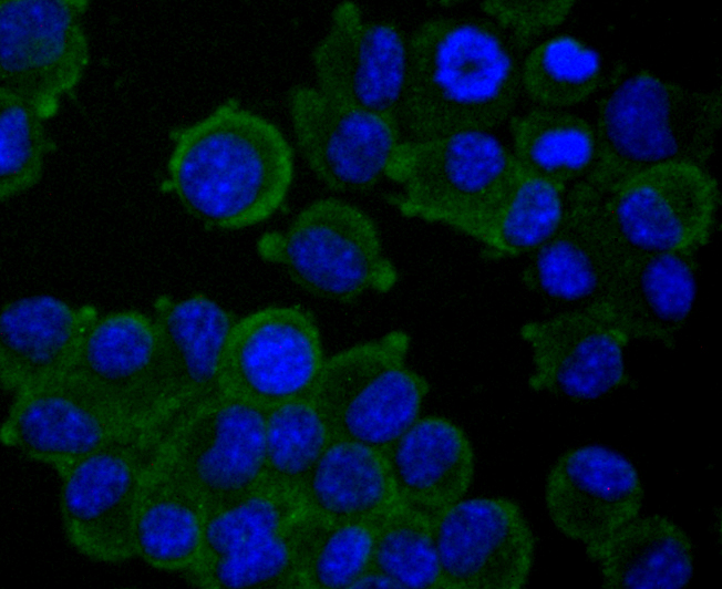 IF(ICC) staining with MAP3K7 (11A1) Monoclonal Antibody (bsm-54071R) at 1:100 in N2A cells (green). The nuclear counterstain is DAPI (blue). Cells were fixed in paraformaldehyde, permeabilized with 0.25% Triton X100/PBS.