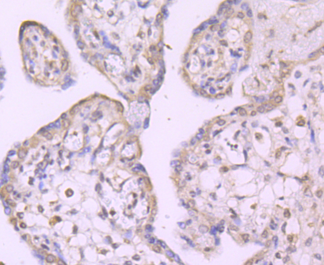 Paraformaldehyde-fixed and paraffin-embedded Human Placenta tissue incubated with MAP3K7 (11A1) Monoclonal Antibody (bsm-54071R) at 1:100, overnight at 4°C, followed by a conjugated secondary antibody and DAB staining. Counterstained with hematoxylin.